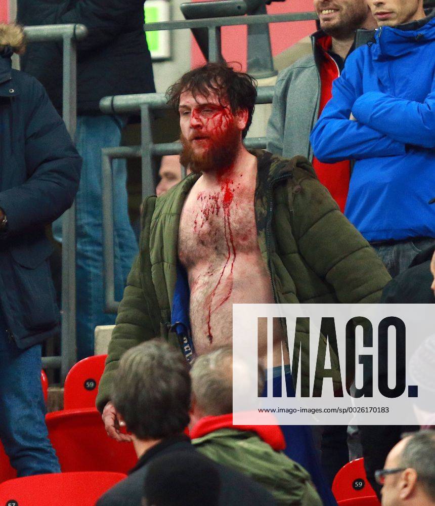 England v Scotland - FIFA World Cup WM Weltmeisterschaft Fussball 2018 Qualifier . . London, UK . . 11.11.2016 Fighting broke out amongst some England supporters, leaving one man covered in blood.