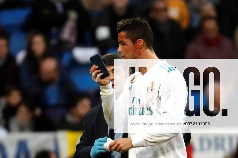 - SPORT Real Madrid s Portuguese striker Cristiano Ronaldo uses a cellphone to check a wound in his face during a Spanish league La Liga soccer match between Real Madrid and Deportivo at Santiago Bernabeu stadium in Madrid, Spain, 21 January 2018. Real Madrid vs Deportivo !ACHTUNG: NUR REDAKTIONELLE NUTZUNG!