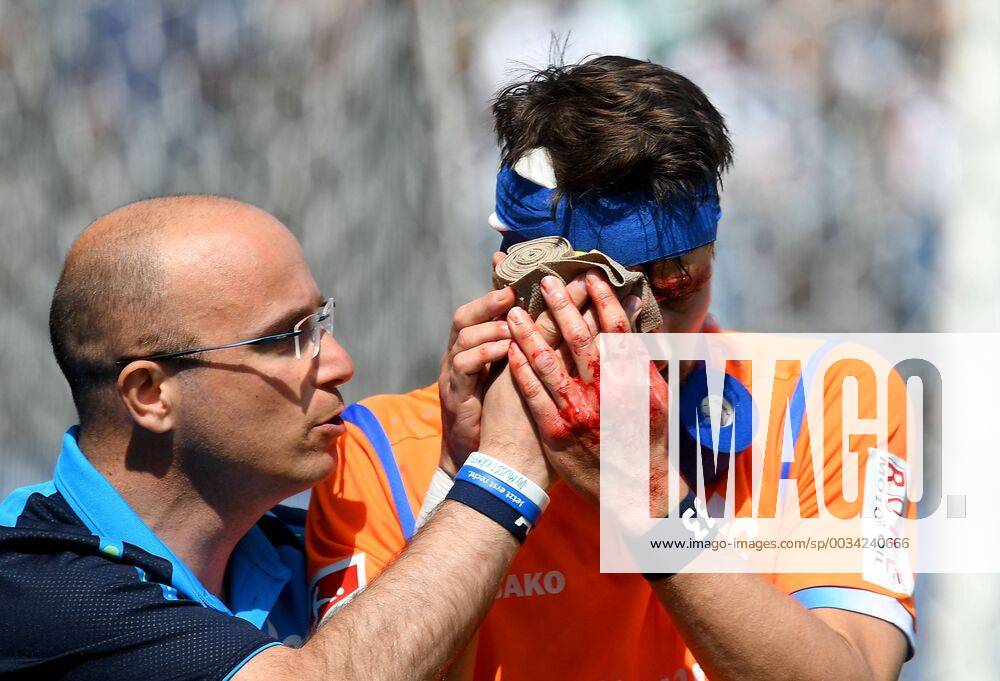 - SPORT 21.04.2018, Fussball 2.Bundesliga, SV Sandhausen - SV Darmstadt 98,, emonline, v.l. Mannschaftsarzt Dr. Alexander vfLesch (SV Darmstadt 98), Romain Bregerie (SV Darmstadt 98) receive an injury, bruise, harried, hurt, injured, injury, trauma, disappointed, crestfallen, verletzt, Verletzung, Blut, blutet, rot, blood im Gesicht Sandhausen