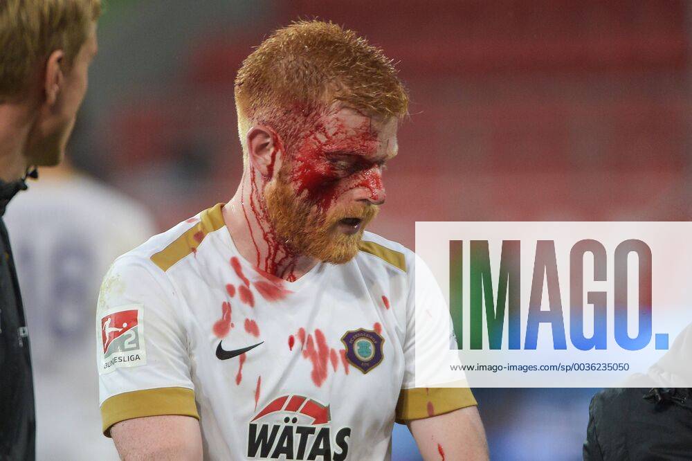 KW35 Verlewtzung bei Fabian Kalig (FC Erzgebirge Aue 4), FC Ingolstadt 04 - FC Erzgebirge Aue, Fussball, 2 Bundesliga, 31.08.2018 DFL REGULATIONS PROHIBIT ANY USE OF PHOTOGRAPHS AS IMAGE SEQUENCES AND OR QUASI-VIDEO Ingolstadt Bayern Deutschland