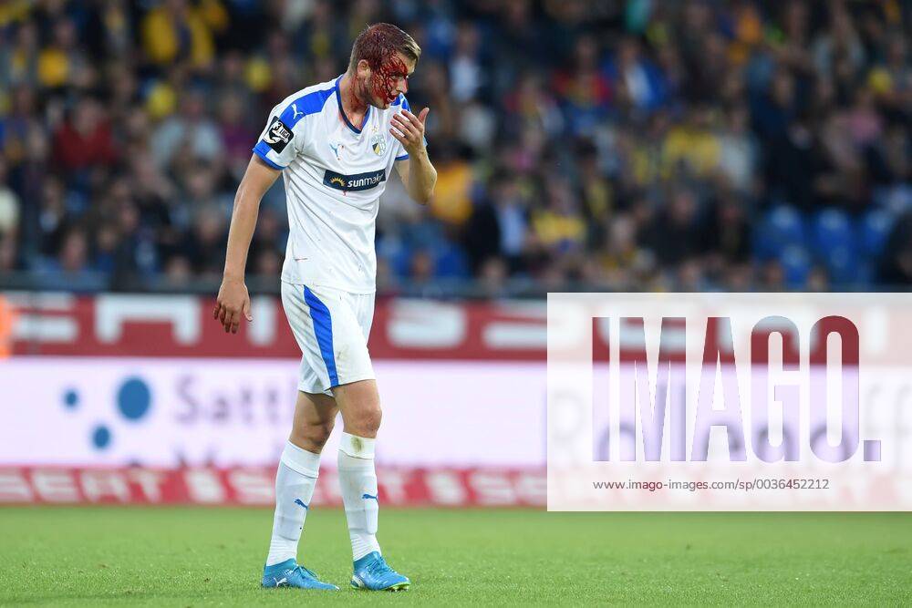 KW37 Fußball 3. Liga 07. Spieltag Eintracht Braunschweig - Carl Zeiss Jena am 14.09.2018 im Eintracht-Stadion in Braunschweig Marius Grösch Groesch (Jena) verlässt blutend das Feld.