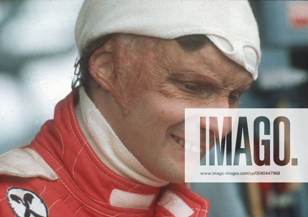 Formel 1 Rennen: Großer Preis von Deutschland auf dem Hockenheimring am 31.07.1977. Niki Lauda (Ferrari) Portrait.