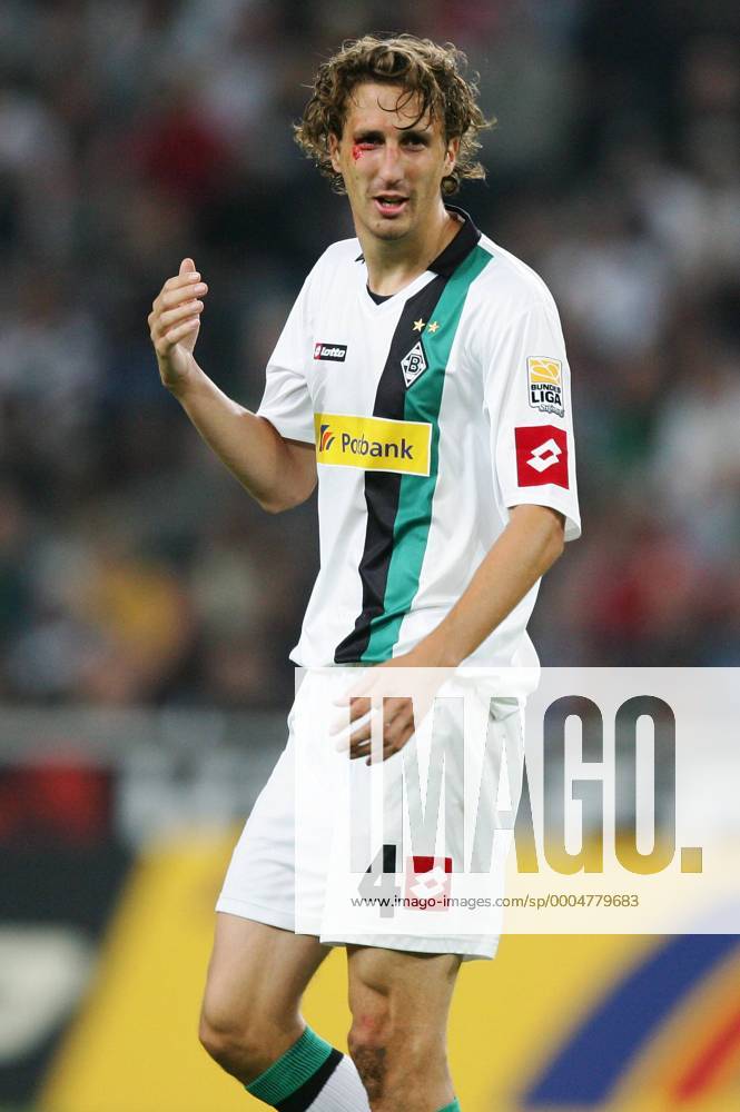Mönchengladbach, Deutschland, 1.Fussball Bundesliga - Saison 2009 2010, Borussia Mönchengladbach, Gladbachs Roel Brouwers mit einem blutenden Auge