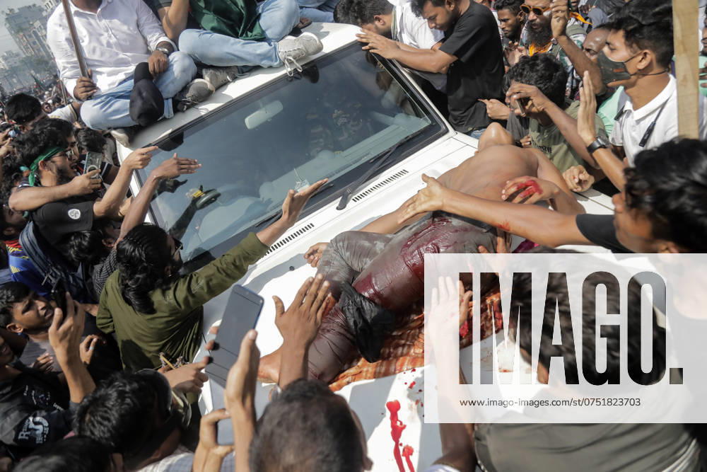 Bangladeshi People Celebrate after PM fleeing Protesters placed an injured protestor on the bonnet of an Army officials vehicle asking for justice who was shot by a police officer during the victory march after the fall of Prime Minister Sheikh Hasina in Dhaka, Bangladesh, August 05, 2024. Dhaka Dhaka Bangladesh
