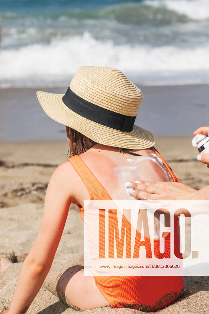 Mutter, die ihrem Kind am Strand ein Spray gegen Sonnenbrand aufträgt Mother applies panthenol foam to her daughter s sunburnt back on a beach (License=RF) ,model released, Symbolfoto