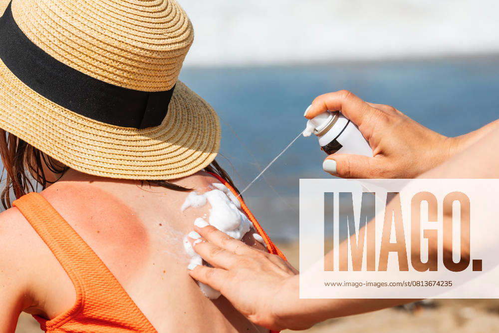 Mutter, die ihrem Kind am Strand ein Spray gegen Sonnenbrand aufträgt Mother spraying panthenol foam on her daughter s sunburnt back on a beach (License=RF) ,model released, Symbolfoto