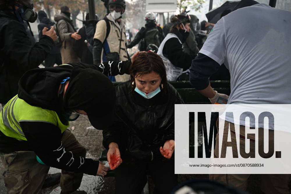 Police intervene in demonstrators amid ongoing protests in Paris PARIS, FRANCE - OCTOBER 24: (EDITOR S NOTE: Image depicts graphic content) A protester gets injured as demonstrators carrying banners, gather during a demonstration amid ongoing social and political tensions in Paris, France, on October 24, 2026. Mouneb Taim Anadolu Paris France. Editorial use only. Please get in touch for any other usage.