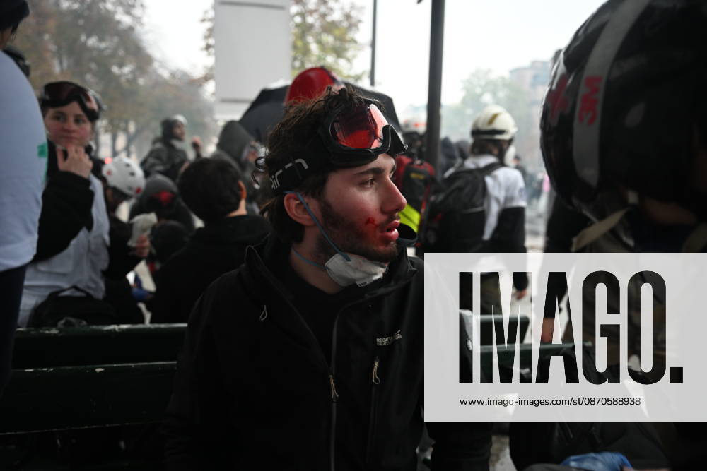 Police intervene in demonstrators amid ongoing protests in Paris PARIS, FRANCE - OCTOBER 24: (EDITOR S NOTE: Image depicts graphic content) A protester gets injured as demonstrators carrying banners, gather during a demonstration amid ongoing social and political tensions in Paris, France, on October 24, 2026. Mouneb Taim Anadolu Paris France. Editorial use only. Please get in touch for any other usage.