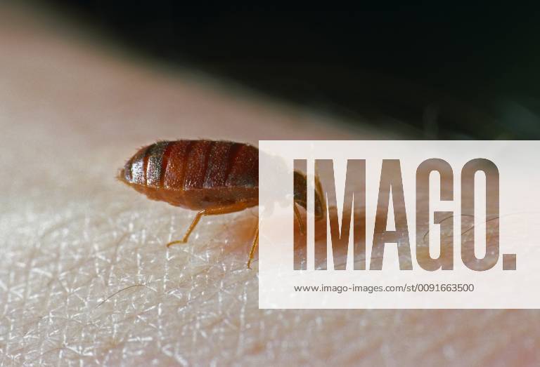 CIMEX LECTULARIUS Bedbug (Cimex lectularius) feeding on human skin, UK 1289581 StephenxDalton