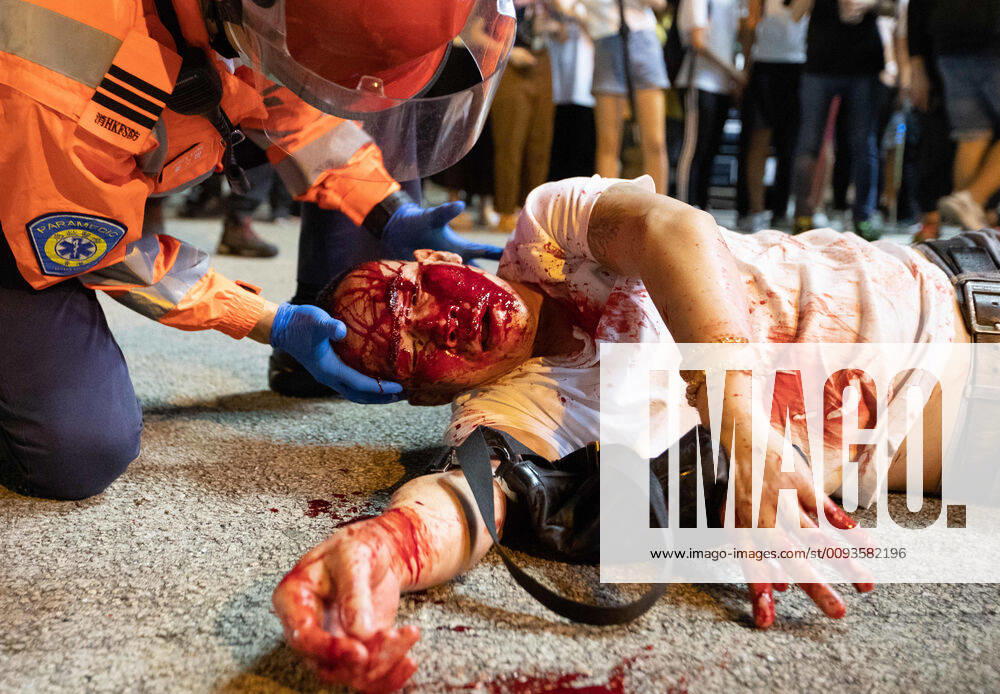 A medic attends to an injured protester during the demonstration..Hong Kong Protest entered its 16th straight weekend. More demonstrations have continued in spite of Hong Kong Chief Executive Carrie Lam s announcement earlier September that the controversial extradition bill will be withdrawn. The unrest citywide protests sparked from the government proposed legislation that would have allowed the extradition of suspected criminals to China for trial. However, it has been widened to include other demands such as an inquiry into alleged police brutality, a halt to categorising the protests as riots and implementation of universal suffrage. Hong Kong China - ZUMAs197 20190922_zaa_s197_015