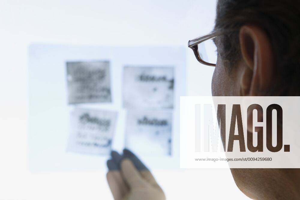 Scientist looking at Xray, close up, back view,model released, Symbolfoto,property released 03C01310