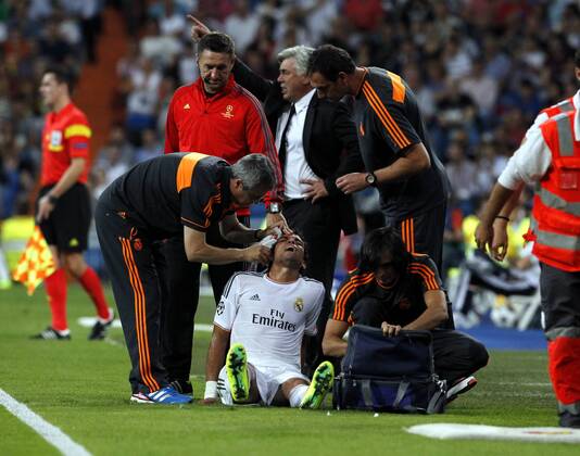 Pepe . Champions League match between Real Madrid vs FC Kopenhagen. . In this picture, Pepe injured. xFOTOxCHEMAxREYx 