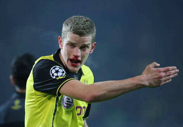 Dortmund, Fussball Männer, UEFA Champions League ,Saison 2013 2014, Achtelfinale, Borussia Dortmund vs SCC Napoli, 26.11.2013, Signal Iduna Park, Dortmund, Sven Bender, BVB, Nase Blut,