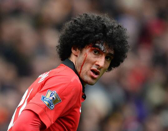 Mauroane Fellaini of Manchester United with blood streaming down his face - Barclays Premier League - Manchester Utd vs Liverpool - Old Trafford Stadium - Manchester - England - 16th March 2014 - Pic Simon Bellis Sportimage EDITORIAL USE ONLY. No use with unauthorised audio, video, data, fixture lists, club league logos or live services. Online in-match use limited to 120 images, no video emulation. No use in betting, games or single club league player publications.