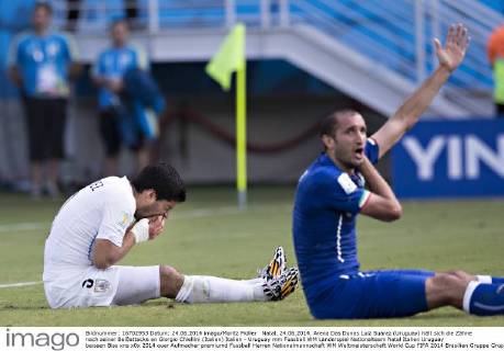 Natal, 24.06.2014, Arena Das Dunas Luiz Suarez (Uruguay) hält sich die Zähne nach seiner Beißattacke an Giorgio Chiellini (Italien) Italien - Uruguay mm