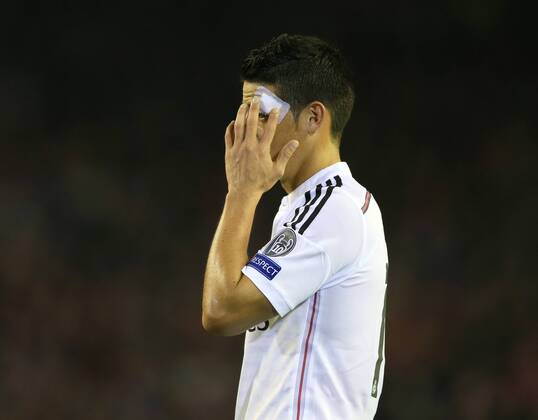 James Rodriguez of Real Madrid holds his wounded head - UEFA Champions League Group B - Liverpool vs Real Madrid - Anfield Stadium - Liverpool- England - 22nd October 2014 - Picture Simon Bellis Sportimage EDITORIAL USE ONLY. No use with unauthorised audio, video, data, fixture lists, club league logos or live services. Online in-match use limited to 120 images, no video emulation. No use in betting, games or single club league player publications.