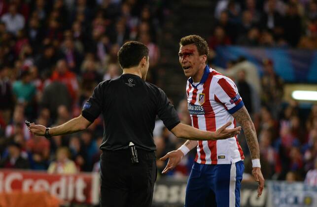 Mario Mandzukic verletzt sich nach einem Schlag im Gesicht, daneben Iker Casillas - Champions League 2014 15, Atletico de Madrid VS Real Madrid 