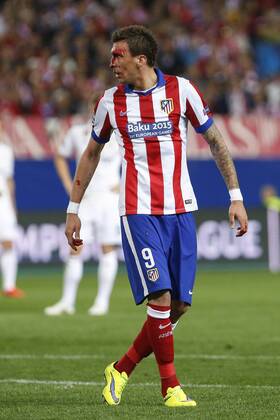 Atletico de Madrid s Mario Mandzukic gets injured with his face covered in blood during quarterfinal first leg Champions League soccer match at Vicente Calderon stadium in Madrid, Spain. April 14, 2015.  (2015041400065)