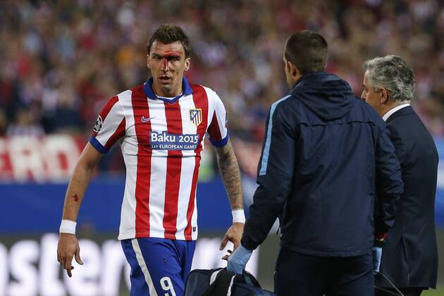 Atletico de Madrid s Mario Mandzukic gets injured with his face covered in blood during quarterfinal first leg Champions League soccer match at Vicente Calderon stadium in Madrid, Spain. April 14, 2015.  (2015041400067)