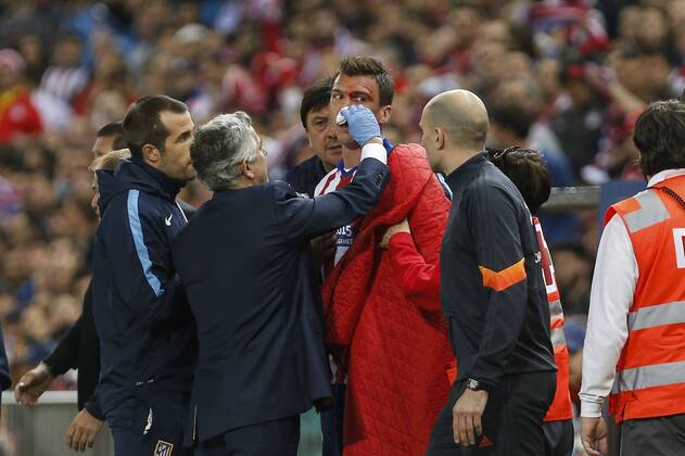 Atletico de Madrid s Mario Mandzukic gets injured with his face covered in blood during quarterfinal first leg Champions League soccer match at Vicente Calderon stadium in Madrid, Spain. April 14, 2015.  (2015041400073)