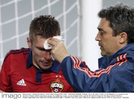 MOSCOW REGION, RUSSIA. JULY 28, 2015. CSKA s Kirill Nababkin (L) injured in the 2015 16 Season UEFA Champions League 3rd qualifying round, 1st leg football match against AC Sparta Prague at the Arena Khimki Stadium. Mikhail Japaridze TASS  TS008973