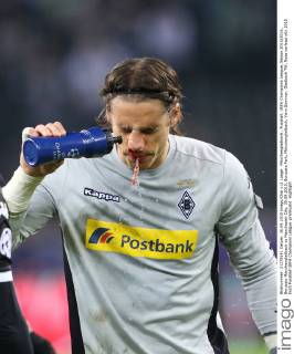 Mönchengladbach , Fussball, UEFA Champions League, Saison 2015 2016, Borussia Mönchengladbach vs Manchester City, 30.09.2015, Borussia Park, Mönchengladbach, Yann Sommer, Gladbach TW, Nase verletzt