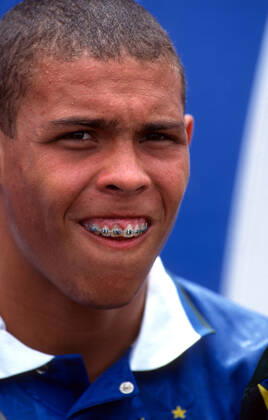 Holland v Brazil 9 July 1994 - FIFA World Cup, WM, Weltmeisterschaft, Fussball USA 1994 - Holland v Brazil - Ronaldo of Brazil shows off his braces - Photo: Mark Leech Offside. Dallas USA Copyright: xMarkxLeechx xOffsidexOffside