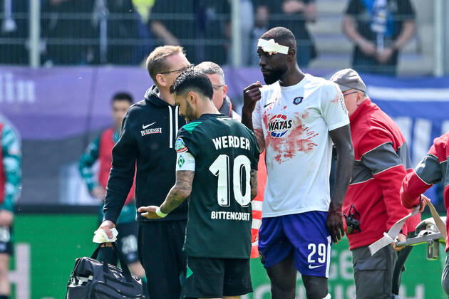 Fußball: 2. Bundesliga, Saison 2021 2022, 33. Spieltag, FC Erzgebirge Aue - SV Werder Bremen am 08.05.2022 in Erzgebirgsstadion in Aue-Bad Schlema. -TK- Aues Prince Owusu mit Blut auf dem Trikot. DFL REGULATIONS PROHIBIT ANY USE OF PHOTOGRAPHS AS IMAGE SEQUENCES AND OR QUASI-VIDEO. Copyright: xTeresaxKrögerx
