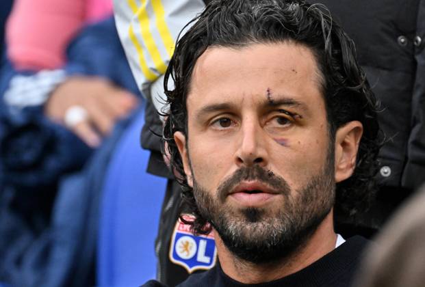 Fabio Grosso (lyon) FOOTBALL: Olympique Lyonnais vs FC Metz - Ligue 1 - 05 11 2023 FredericChambert Panoramic