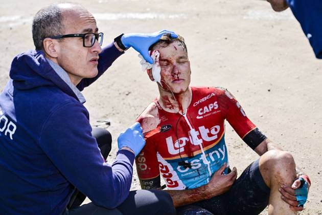 Bilder des Jahres 2024, Sport 03 März Sport Themen der Woche KW09 Belgian Arjen Livyns of Lotto Dstny lies injured on the ground during the men s elite race of the Strade Bianche one day cycling race (215km) from and to Siena, Italy, Saturday 02 March 2024. DIRKxWAEM  x87846314x