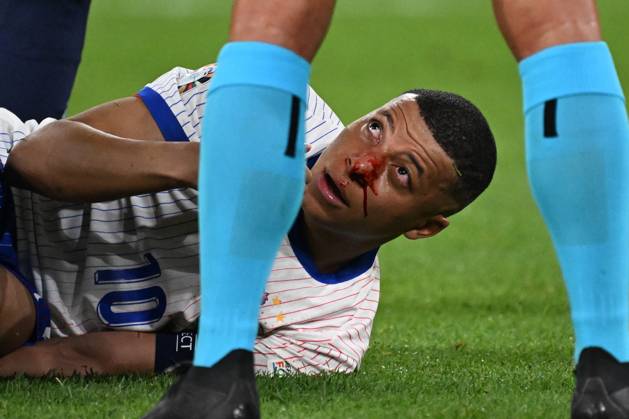Bilder des Jahres 2024, Sport 06 Juni Sport Themen der Woche KW25 Sport Bilder des Tages 17.06.2024, xjhx, Fussball EM 2024, Österreich - Frankreich emspor, v.l. Kylian Mbappe Lottin (Frankreich) mit Schmerzen, verletzt, Verletzung blutet Nase Nasenbluten (DFL DFB REGULATIONS PROHIBIT ANY USE OF PHOTOGRAPHS as IMAGE SEQUENCES and or QUASI-VIDEO) Düsseldorf