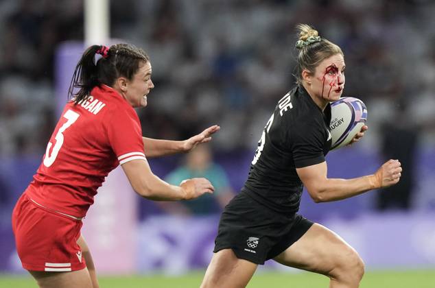 Bilder des Jahres 2024, Sport 07 Juli Sport Themen der Woche KW30 Sport Bilder des Tages July 28, 2024, Paris, FRANCE: New Zealand back Michaela Blyde (6) runs with the ball with a bloodied face against Canada forward Alysha Corrigan (3) during second half women s rugby 7s action at the 2024 Summer Olympics in Paris, France on Sunday, July 28, 2024. Canada News - July 28, 2024  - ZUMAc35_ 20240728_zaf_c35_144 Copyright: xNathanxDenettex