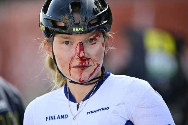Bilder des Jahres 2024, Sport 09 September Sport Themen der Woche KW37 Sport Bilder des Tages Finnish Turpeinen Viivi pictured with an injury after the Women s Junior Road Race at the European Championship, EM, Europameisterschaft 2024, in Hasselt, Sunday 15 September 2024. The UEC Road European Championships 2024 will take place from 11 to 15 september in Limburg, Belgium. DIRKxWAEM  x100679296x