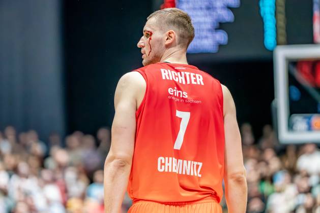 Bilder des Jahres 2024, Sport 11 November Sport Themen der Woche KW44 Sport Bilder des Tages Chemnitz, Deutschland 03. Oktober 2024: 1.BBL - 2024 2025 - Niners Chemnitz vs. BG Göttingen Im Bild: Jonas Richter (Chemnitz) am Kopf verletzt mit Blutung Copyright: xFotostandx xNachtigallx