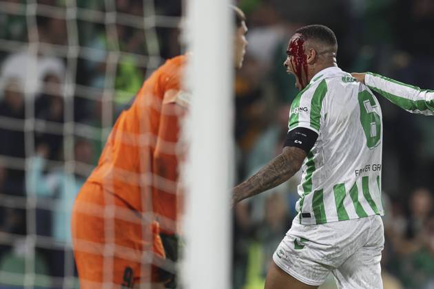 Bilder des Jahres 2024, Sport 11 November Sport Themen der Woche KW45 ESP: Real Betis - NK Celje. UEFA Conference League. Natan Souza of Real Betis injury during the UEFA Conference League match between Real Betis and NK Celje played at Benito Villamarin Stadium on November 7 2024 in Sevilla, Spain. kpng Copyright: xAntonioxPozox xPRESSINPHOTOx AP_241107_BET_CEL_021