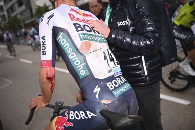 2025 Volta Algarve cycling race - Stage 3 TAVIRA, PORTUGAL - FEBRUARY 21 : injury of Koch Jonas (GER) of Red Bull - Bora - Hansgrohe after stage 3 of the 51th edition of the Volta Algarve cycling race, with start in Vila Real Santo Antonio and finish in Tavira on February 21, 2025 in Tavira, Portugal, 21 02 2025 ( Motordriver Kenny Verfaillie - Tavira Portugal Copyright: xTomasxSiskx
