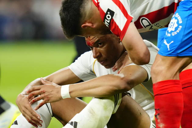 Real Madrid CF v Girona FC - LaLiga EA Sports Kylian Mbappe centre-forward of Real Madrid and France lies injured on the pitch during the La Liga EA Sports match between Real Madrid CF and Girona FC at Estadio Santiago Bernabeu on April 10, 2026 in Madrid, Spain. Madrid Spain  Copyright: xJosexBretonx originalFilename:bretonhernandez-realmadr260410_nprqe.jpg