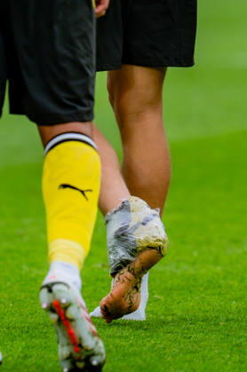 1. Bundesliga, 3. Spieltag, Borussia Dortmund vs. SC Paderborn 07 am 12.09.2026 Nico Schlotterbeck mit Eis am Fuss Eiwürfel Copyright: xBahhoxKarax