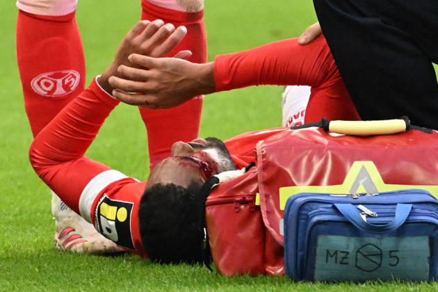 10.10.2026, xsltx, Fussball 1.Bundesliga, FSV Mainz 05 - Bayer 04 Leverkusen v.l. Philipp Mwene (FSV Mainz 05) verletzt, Verletzung, Schmerz, Schmerzen (DFL DFB REGULATIONS PROHIBIT ANY USE OF PHOTOGRAPHS as IMAGE SEQUENCES and or QUASI-VIDEO) Mainz