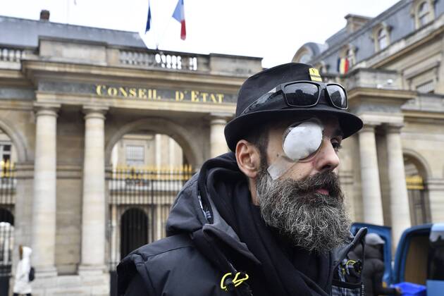 News Themen der Woche KW05 News Bilder des Tages Jerome Rodriguez the Yellow Vest wounded in Bastille during act XI yellow vests, in front of the Council of State or was filed an appeal for the ban of launchers type LBD (Flashball).  JulienxMattiax xLexPictorium LePictorium_0199438