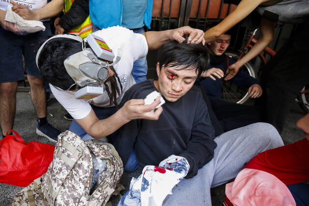 Concepcion, 21 October 2019 Students injured after facing Carabineros Special Forces on third day of social discontent protests in Concepcion Esteban Paredes Aton Chile, Aton 361579  Copyright: ESTEBANxPAREDES ATONxCHILE