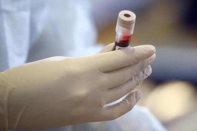 MOSCOW REGION, RUSSIA - APRIL 15, 2020: A test tube with donated blood held by a healthcare worker during a blood donating campaign titled From Heart to Heart in a gym at the Moscow Region Main Directorate of Russia s Federal National Guard Service (Rosgvardia) in the town of Reutov. The campaign is organized by medical brigades of a special medical complex fitted with air disinfection equipment. Sergei Fadeichev TASS  TS0D5D26
