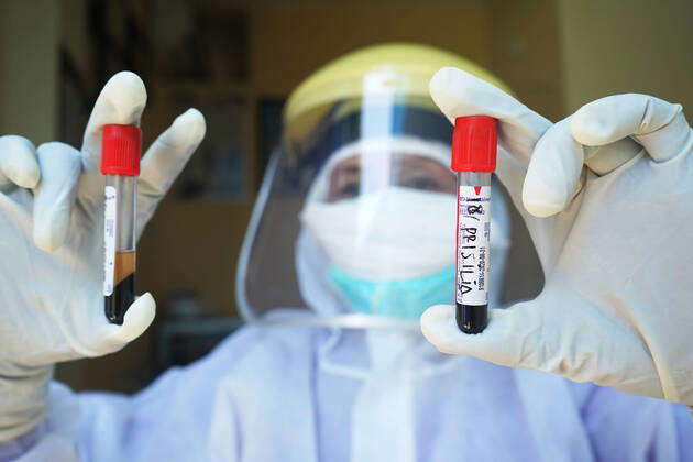 Coronavirus in Indonesien, Eindrücke aus Makasar Indonesia: Rapid Test for Covid-19 Health workers from the Community Health Center showed blood samples for rapid testing conducted to determine the spread of the Covid-19 outbreak. The Indonesian government reports that the number of people infected with Covid-19 has reached 7,418 people. Makassar South Sulawesi Indonesia Copyright: HerwinxBahar
