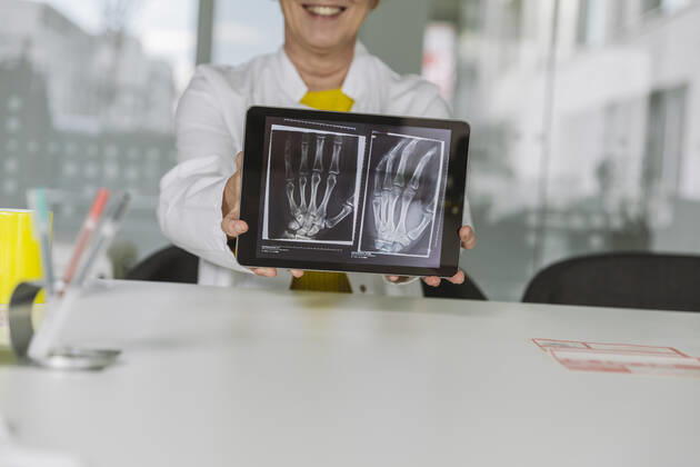 Doctor sitting at desk showing x-ray image of hand on digital tablet model released Symbolfoto property released MFF05500