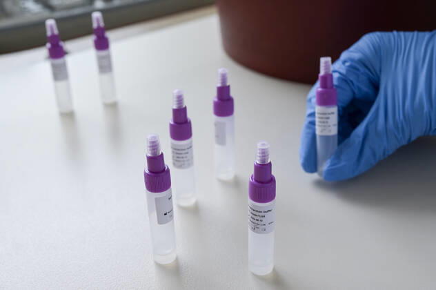 GERMANY, corona virus, fast testing GERMANY, Hamburg, fast testing for visitors in nursing home for old people