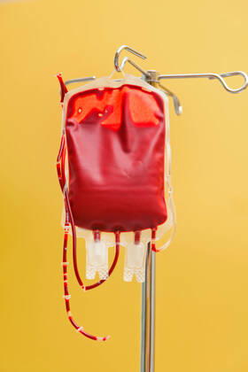 Weltblutspendetag am 14. Juni Eine Blutkonserve zur Infusion in eine Klinik. Spenderblut wird verabreicht. McPBBO