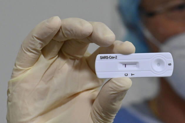 09.03.21, Deutschland, Nordrhein-Westfalen, Essen. Coronaschnelltestzentrum in der Grugahalle Essen. Ab dem 08. Maerz koennen sich Bundesbuerger 1x woechentlich kostenlos auf Corona in einem Schnelltestzentrum testen lassen. Blick in eine Schnelltestkabine in der Grugahalle Essen. Arzt zeigt ein negatives Testergenbnis auf einem Teststreifen. Corona Schnelltestzentrum Grugahalle Essen