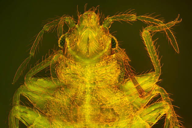 Gemeine Bettwanze, Bettwanze, Bett-Wanze, Hauswanze, Haus-Wanze (Cimex lectularius), stechend-saugende Mundwerkzeuge, Dunkelfeld- und fluoreszenzlichtmikroskopische Aufnahme Bedbug, Common bedbug, Wall-louse (Cimex lectularius), piercing-sucking mouth parts, dark field and phase-contrast MRI image BLWS646764