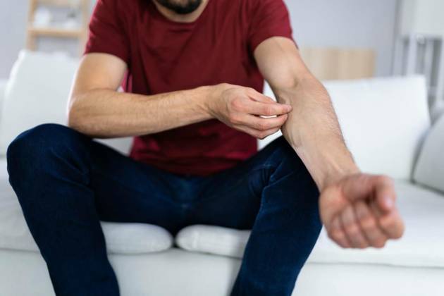 Man With Itchy Skin, Man With Itchy Skin. Allergy Or Psoriasis, Man With Itchy Skin. Allergy Or Psoriasis model released, Symbolfoto , 09.09.2022, Copyright: xAndreyPopovx Panthermedia31832021.jpg