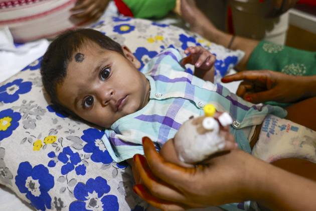 Bangladesh Confronts Surge In Dengue Cases - Dhaka Children suffer from dengue fever receive medical treatment at a hospital, in Dhaka, Bangladesh, July 14, 2023. . Dengue infection has increased five times since 1 January to 31 May this year in Bangladesh. Children aged less than 15 years suffer from dengue fever the most. Dengue infection rates are usually high during monsoon and in the slum areas. Four variations of this virus have been identified. If infected with more than one variation or for the second time, severity of the infection is way more intense. Since many children are being diagnosed with dengue for the second or third time now, the situation is getting complicated. Meanwhile, many children with dengue infection are being a Copyright: xSuvraxKantixDas ABACAx 860725_019 SuvraxKantixDas ABACAx 860725_019